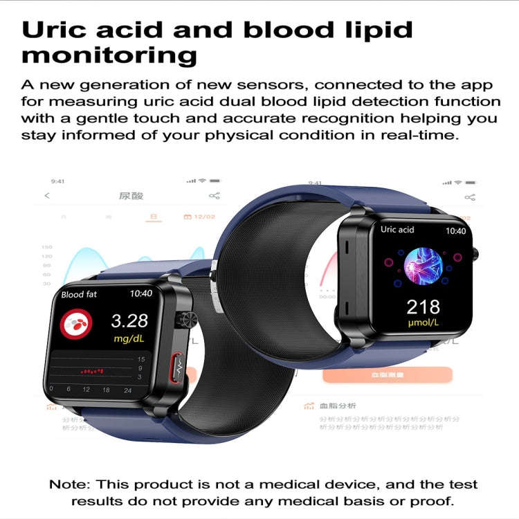 S11 1.92 inch Color Screen Smart Watch, Support Air Pump + Balloon Type Accurate Blood Pressure T...