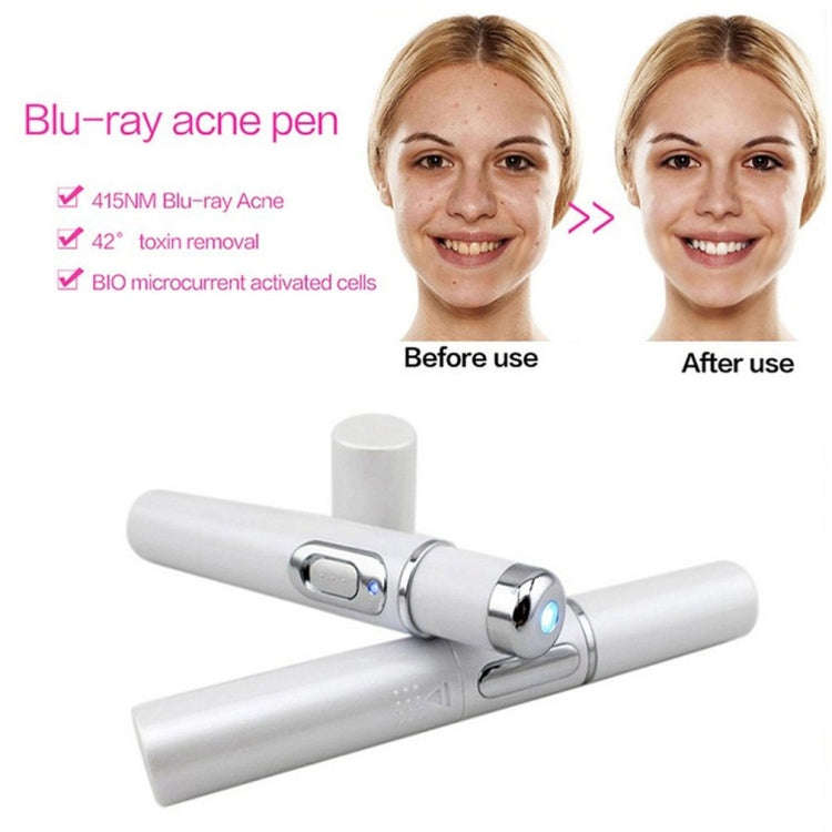 K-SKIN KD-7910 Acne Laser Pen Portable Wrinkle Removal Machine Durable Soft Scar Remover Device B...