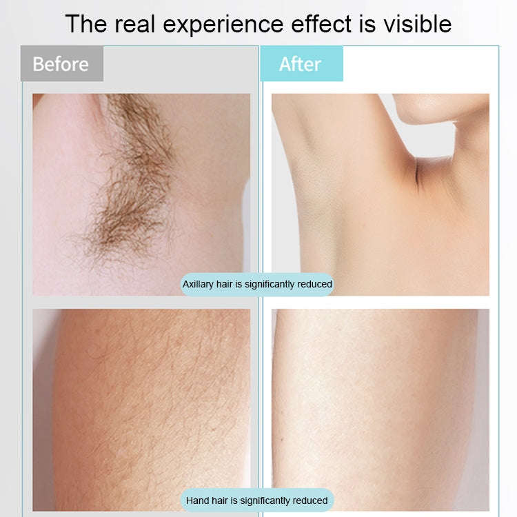 K_SKIN KD506A Epilator Household Freezing Photon Hair Removal Instrument 5 Levels of Light Intens...