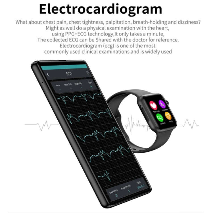 W34 1.54 inch IPS Color Screen Smart Watch,Support Call Reminder /Heart Rate Monitoring/Sleep Mon...