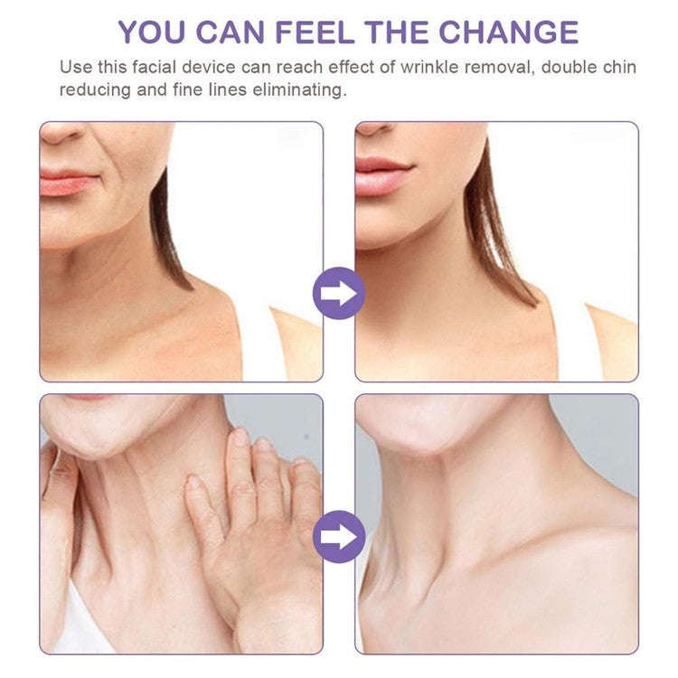Electric Dolphin Neck Massager Wrinkle Removal Handheld Vibration Neck Face Massage Beauty Instru...