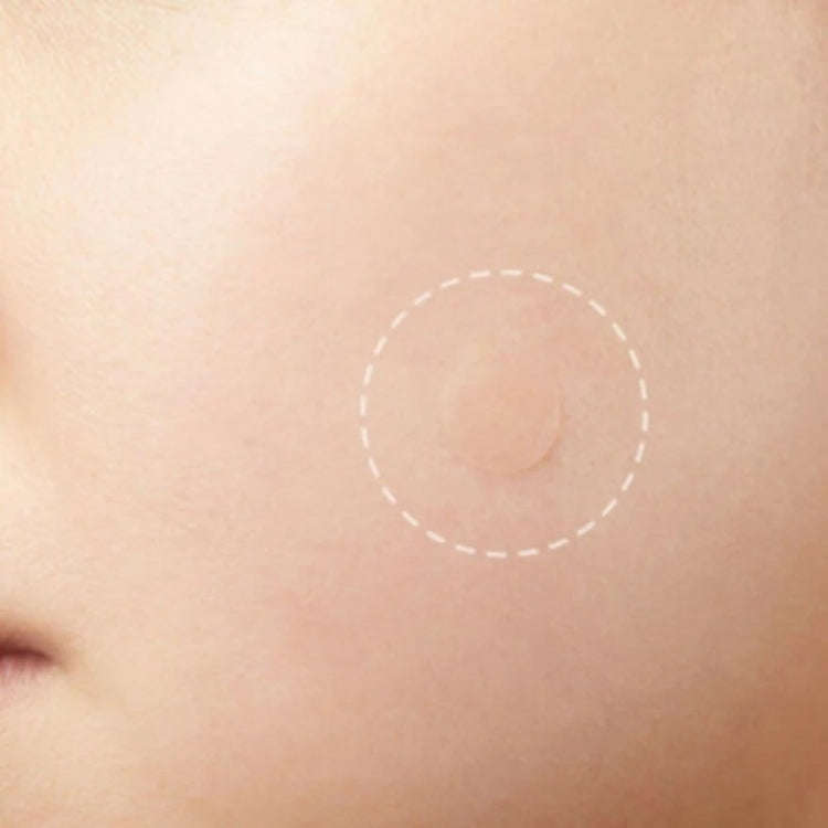 3 PCS Acne Tool Set Treatment Acne Scar  Pimples Sticker