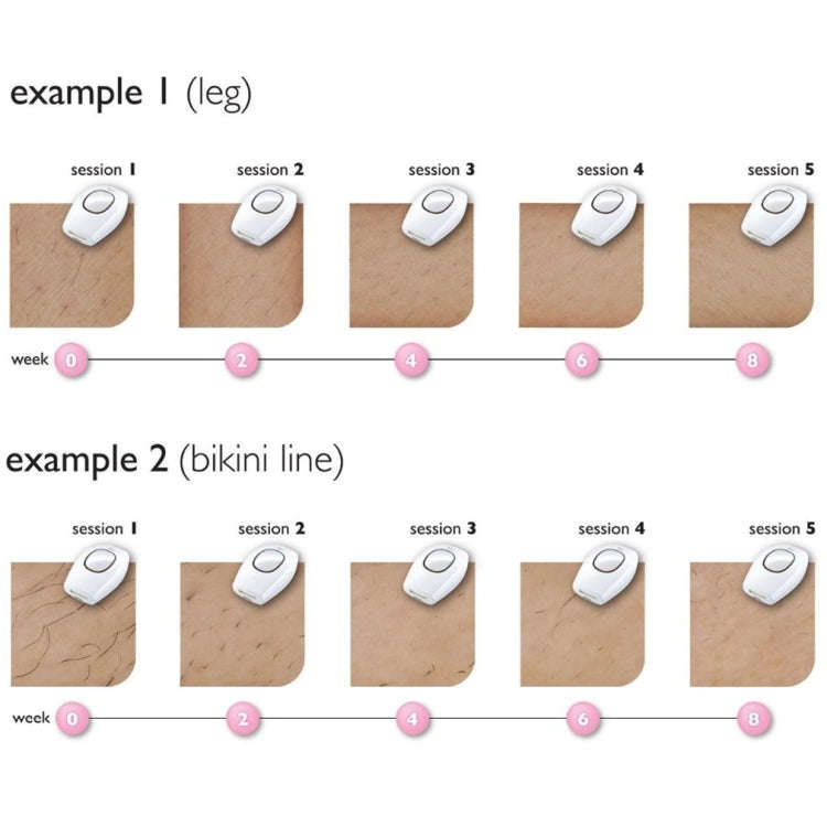 Aimanfun 100000 Flash Professional IPL Epilator Laser Hair Removal Women Painless Threading Hair ...