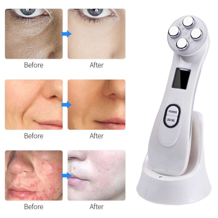 Radio Mesotherapy Electroporation Face Beauty Pen Radio Frequency LED Photon Face Skin Rejuvenati...