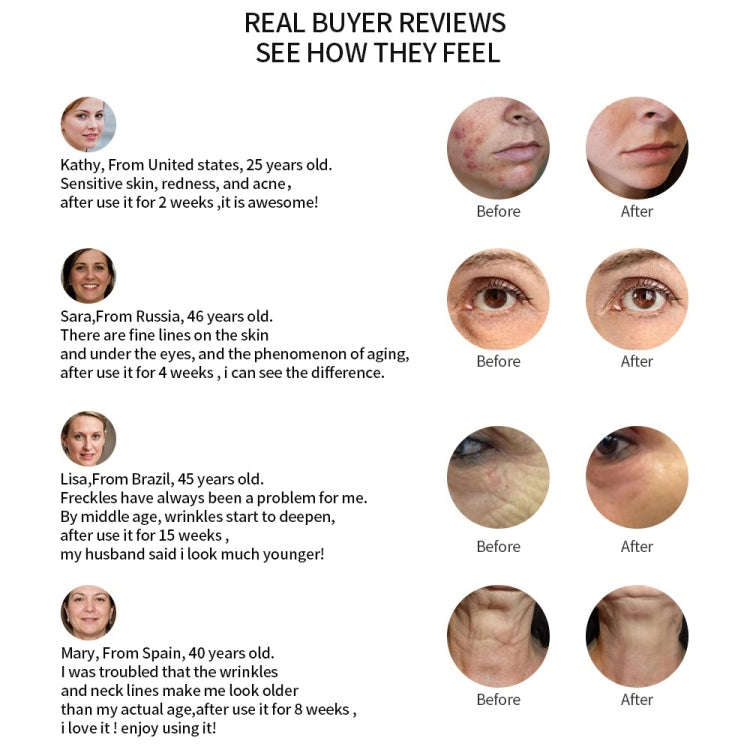 Radio Mesotherapy Electroporation Face Beauty Pen Radio Frequency LED Photon Face Skin Rejuvenati...