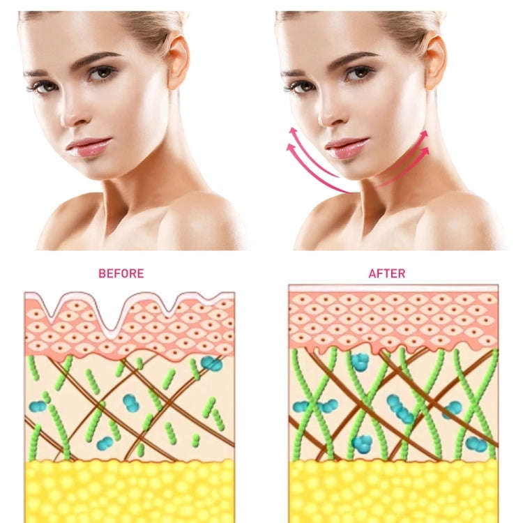 A210 Household Skin Rejuvenation Micro-current Beauty Instrument Facial Radio Frequency Massage I...