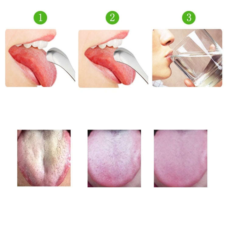 Tongue Cleaner Bad Breath Stainless Steel Cleaning Brush Tongue Scraper + Two-piece Set (Rose Gold)
