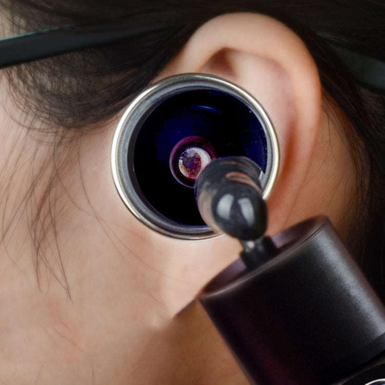 Ear Cleaning Hand Lamp USB Charging Otoscope(Elegant Gold)
