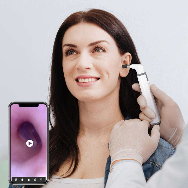 TESLONG SA39W 3.9mm Camera Lens WiFi Smart Visual Ear Scoop(SA39W)