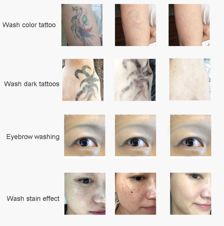 Laser Tattoo Removal Machine Non-invasive Eyebrow Washing Beauty Equipment(US Plug)