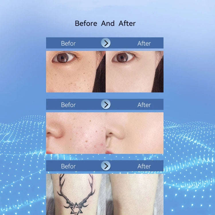 15 Gears Rechargeable Mole Spotting Pen Laser Beauty Instrument Spot Removal Magic Tool(Silver)