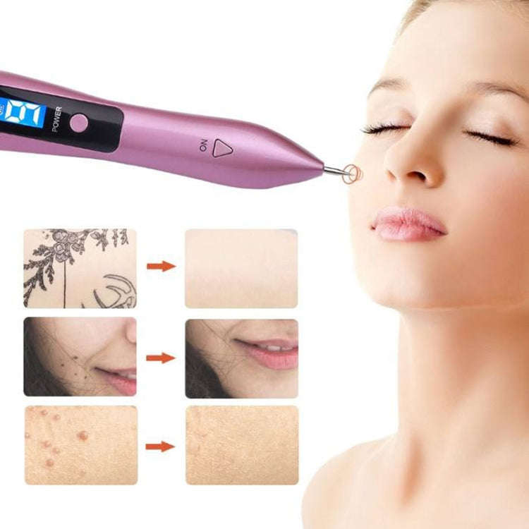 9 Gears Mole Spotting Pen LCD Home Laser Mole Spot Sweeping Beauty Instrument With Shot Light(Ros...
