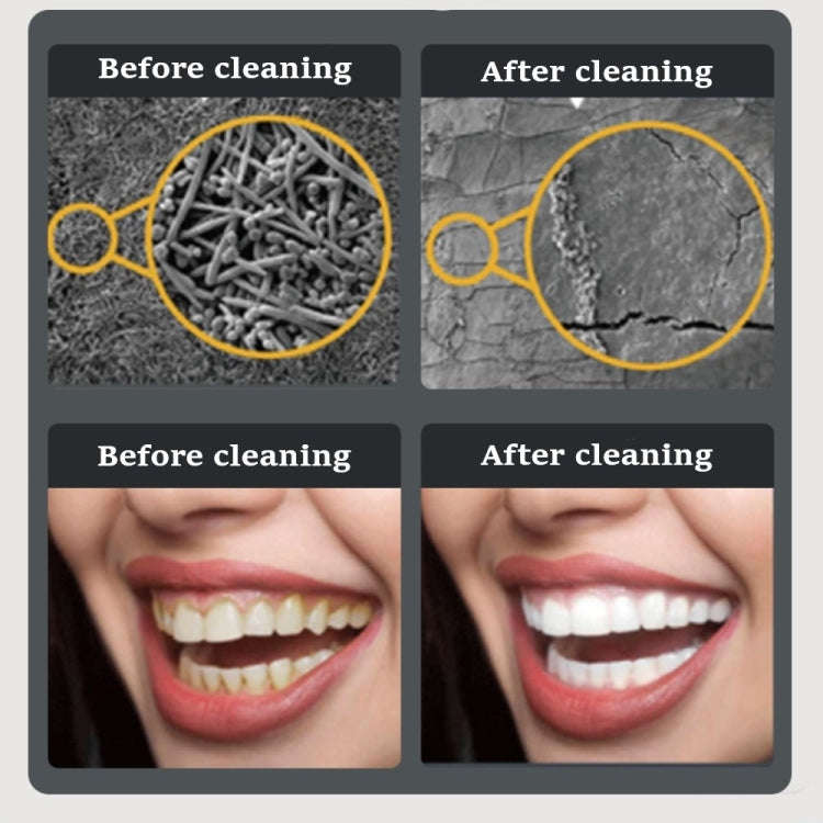 Ultrasonic Electric Dental Scaler Teeth Plaque Cleaner Dental Stone Removal With LED Light, Spec:...