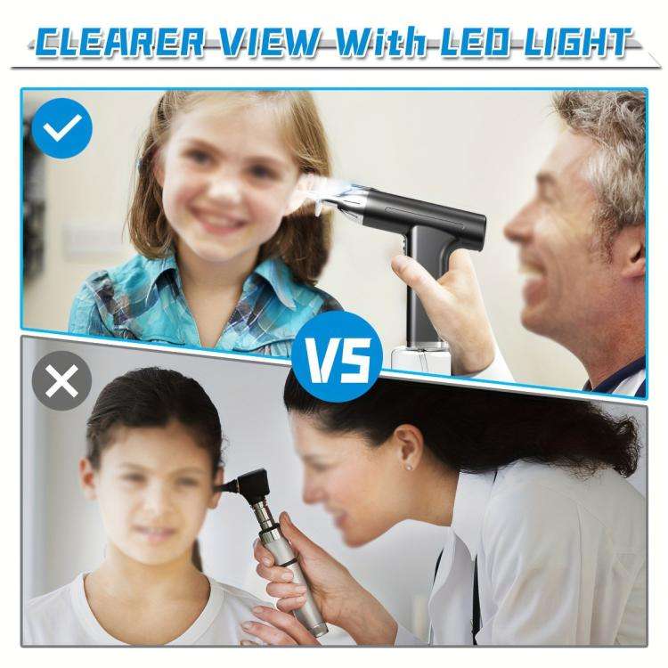 LED Light Low-noise and High-endurance Ear Cleaner Rechargeable Earwax Remover(White)