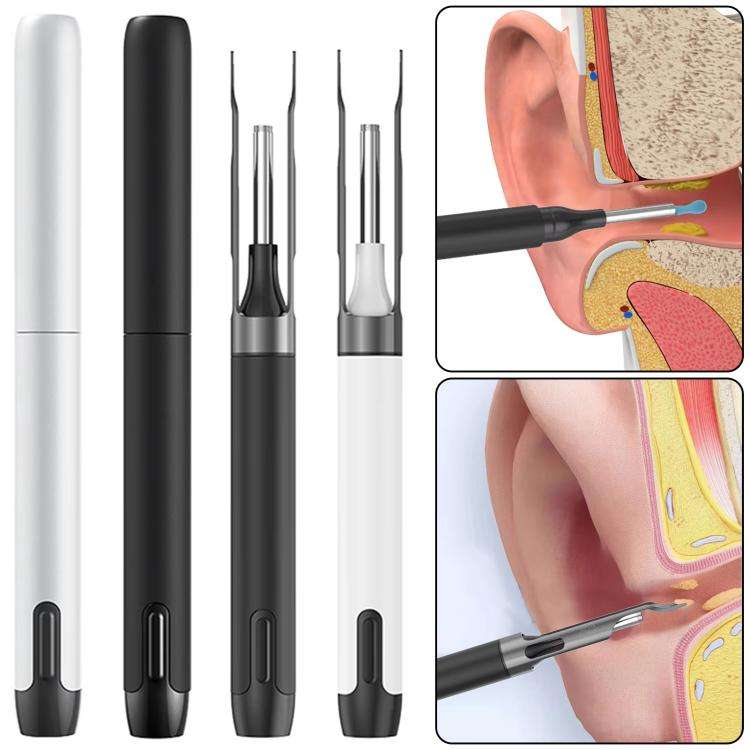 P5 Smart WIFI Connection Visible 10 Million Pixel HD Detachable Ear Spoon With APP(Black)