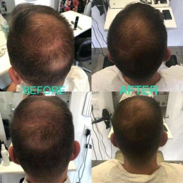NU SKIN Ageloc Nutriol Scalp & Hair Treatment System