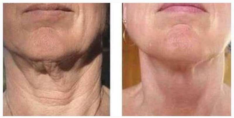 NU SKIN Ageloc Galvanic Spa Device