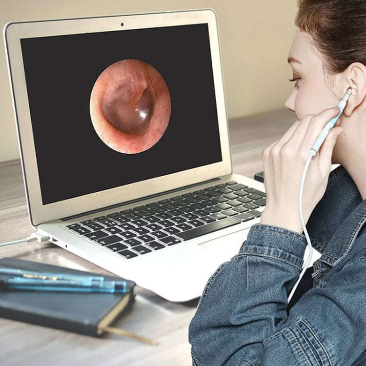 i95 3 in 1 USB Ear Scope Inspection HD 0.3MP Camera Visual Ear Spoon for OTG Android Phones & PC ...
