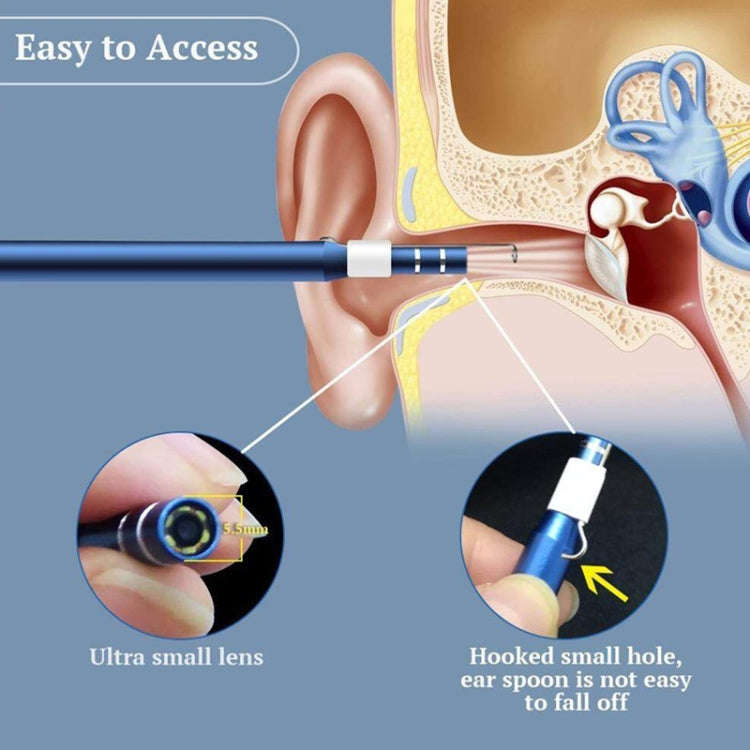 i95 3 in 1 USB Ear Scope Inspection HD 0.3MP Camera Visual Ear Spoon for OTG Android Phones & PC ...