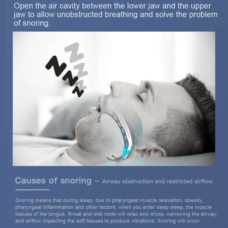YJK100 Silicone + ABS Stop Snoring Device Anti Snore (White)