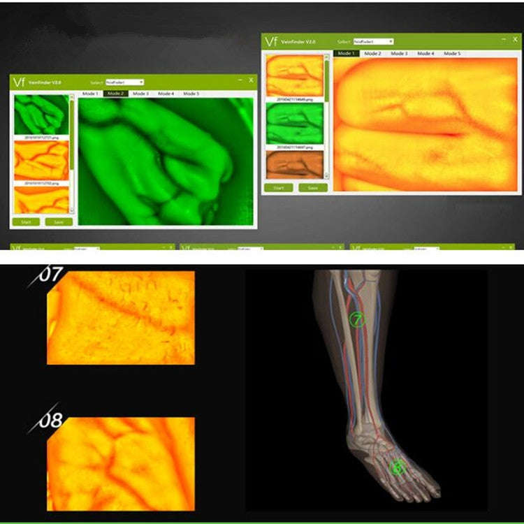 P2-1 Vascular Vein Display Inspection Camera