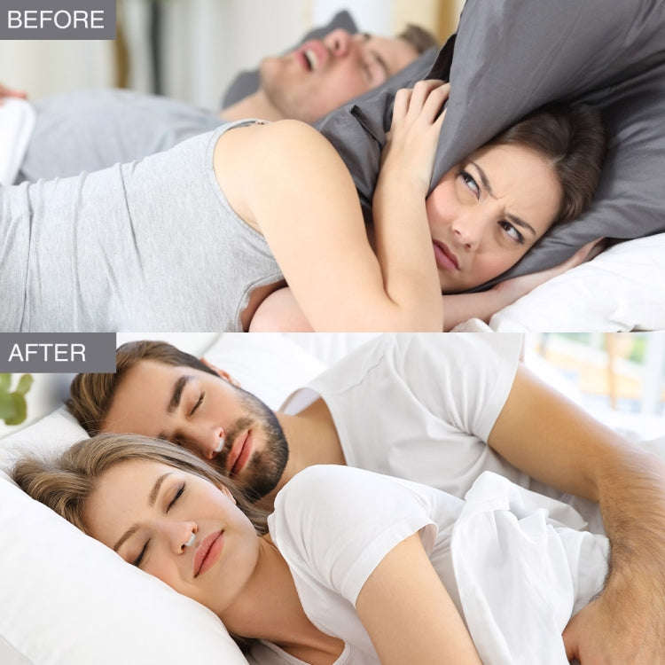 Magnetic Anti Snore Device Stop Snoring Nose Clip Sleeping Aid  Apnea Guard Blister Packaging