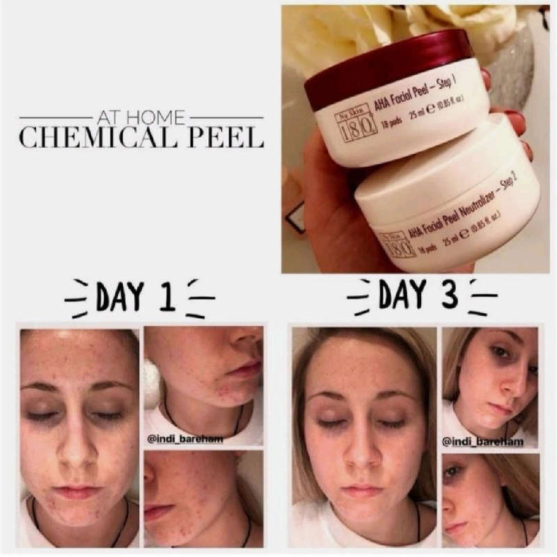 NU SKIN 180° AHA Facial Peel & Neutraliser