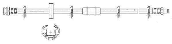 Brake Hose - Abh701 (Argus Motoring)