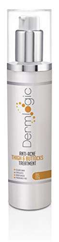 Anti-Acne Thigh & Buttocks Treatment - Clears Away Acne, Pimples, and Ingrown Hairs for the Butto...