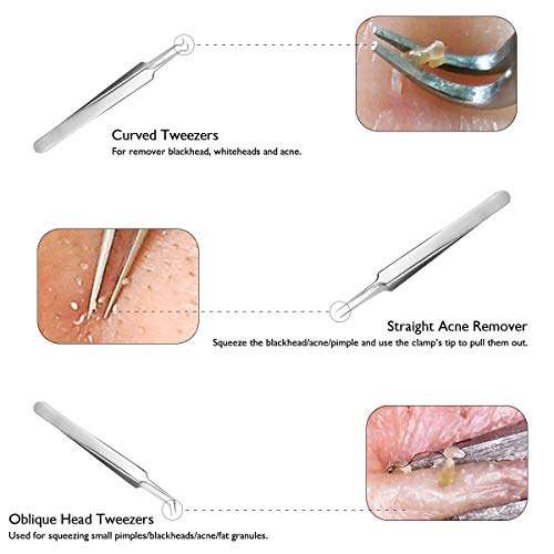 Pimple Popper Tool, Aooeou Stainless Steel Pimple Acne Blackhead Remover Curved Tweezer Treatment...
