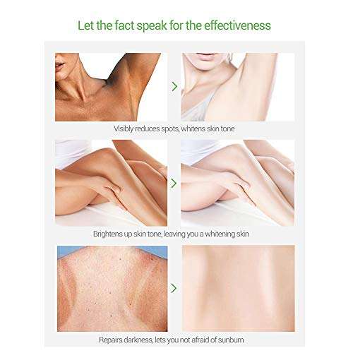 Whitening Cream,Facial Brightening Cream,Natural Whitening Cream,Skin Lightening Cream,Dark Spot ...
