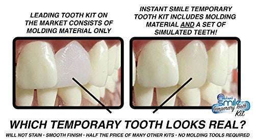 Instant Smile Temporary Tooth Kit - 3 Shades Included (Bright, Natural, Dark) - Does Not Stain an...