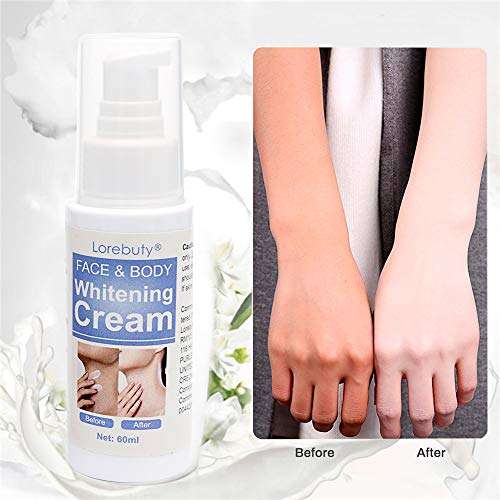 Whitening Cream,Facial Brightening Cream,Natural Whitening Cream,Skin Lightening Cream,Dark Spot ...