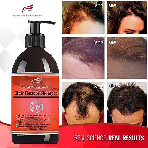 2019 HAIR RESTORATION LABORATORIES' HAIR RESTORE DHT BLOCKING HAIR LOSS...