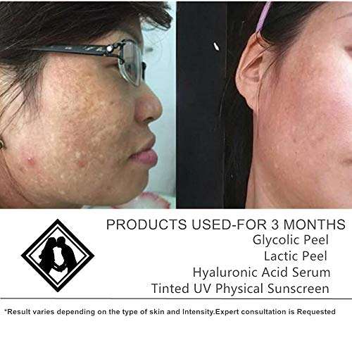 ASDM Beverly Hills Glycolic Acid Peel 2 FL OZ (40% Glycolic Acid 2 OZ)