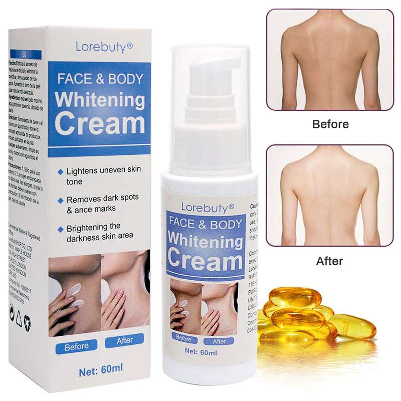 Whitening Cream,Facial Brightening Cream,Natural Whitening Cream,Skin Lightening Cream,Dark Spot ...