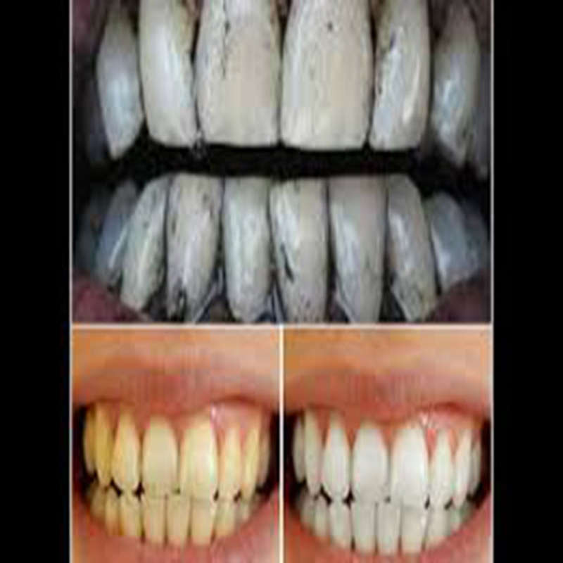 Dr Rashel Charcoal toothpaste...For sparkling teeth