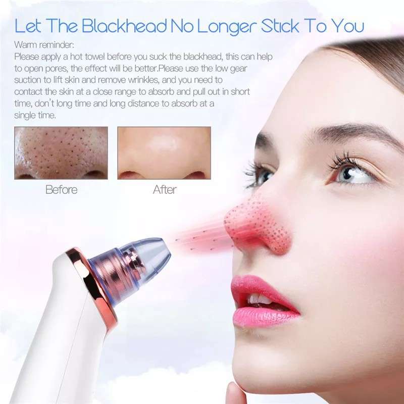 Andowl Blackhead Suction Instrument Q-M301