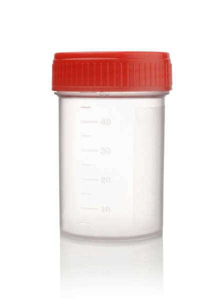 Specimen Containers Sterile