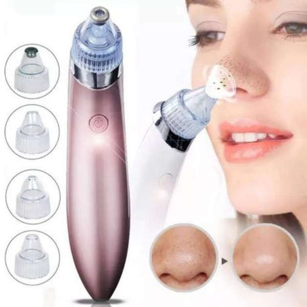 MSM - Acne Blackhead Pore Cleaner Pimple Remover Vacuum