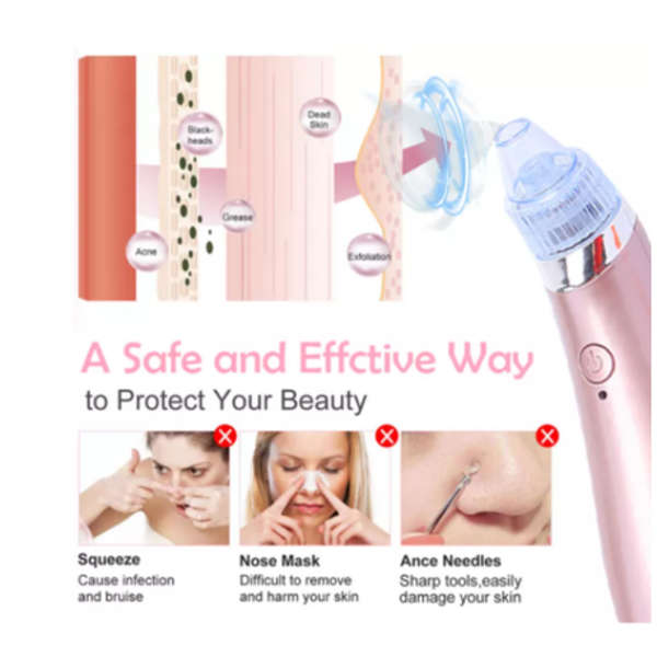 MSM - Acne Blackhead Pore Cleaner Pimple Remover Vacuum
