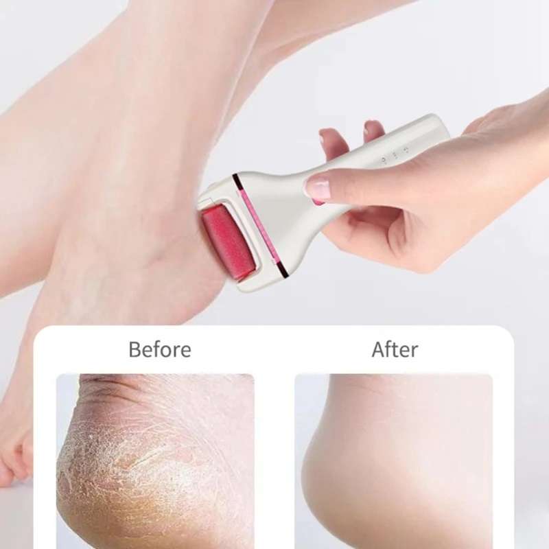 Aerbes AB-MJ01 Rechargeable Feet Pedicure Grinder 600Mah Battery 5W