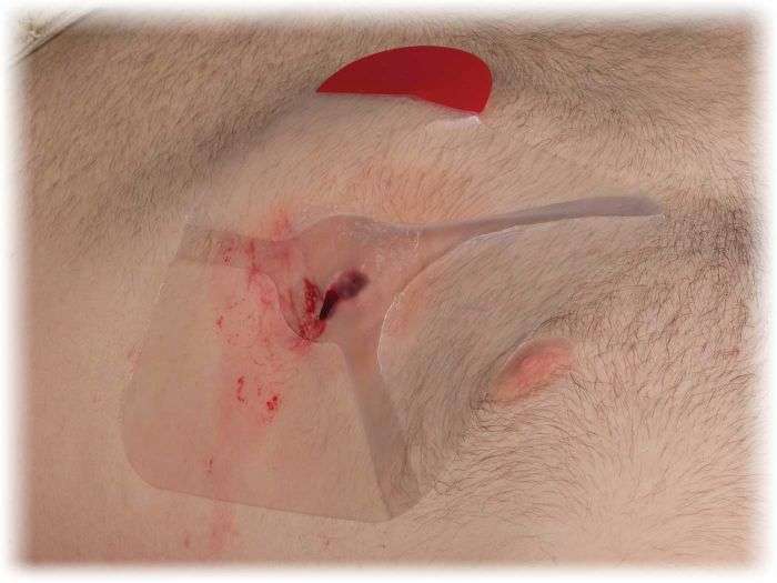 Hyfin Vent Chest Seal Twin Pack