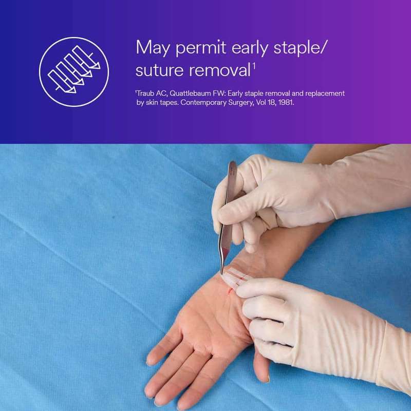 SteriStrip Reinforced Adhesive Skin Closures