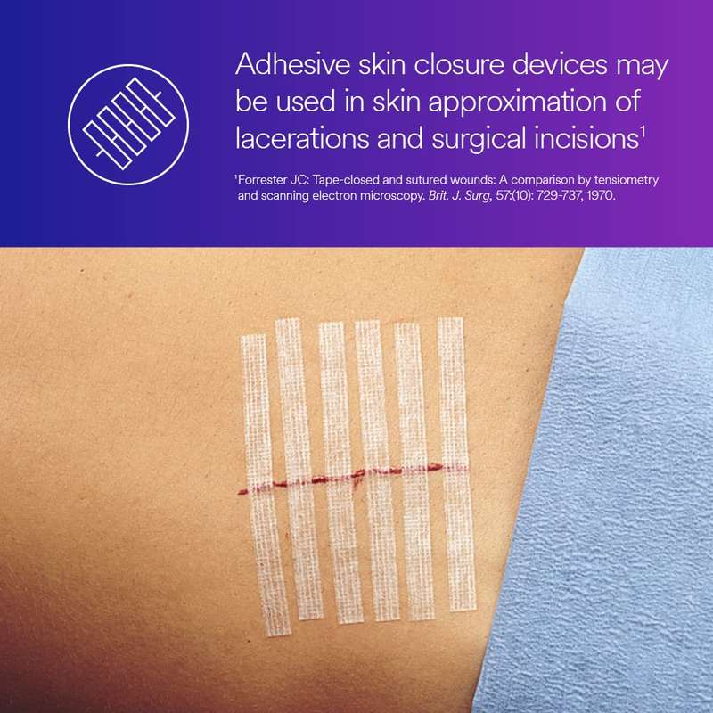 SteriStrip Reinforced Adhesive Skin Closures