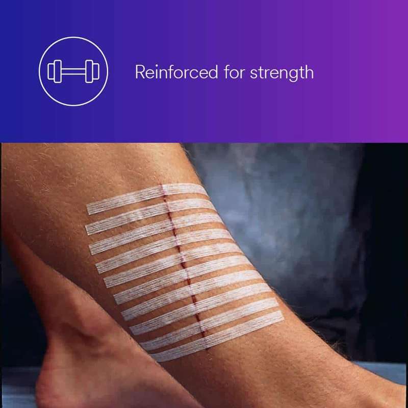SteriStrip Reinforced Adhesive Skin Closures