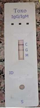 Toxo IgG / IgM - S/P/WB