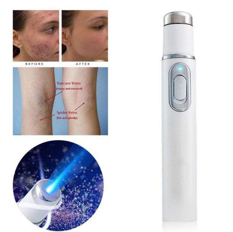 Electronic Laser Blue Light Therapy Acne Removal Light.