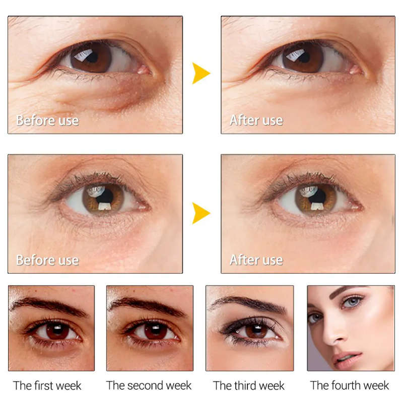 Instant Wrinkle Remover Cream