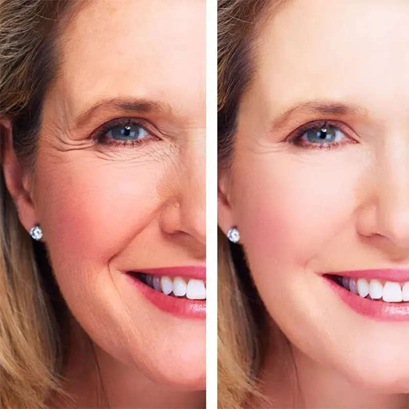 Instant Wrinkle Remover Cream